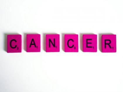 Research: Innovative cancer chemoimmunotherapy provided by novel nanoparticles | Research: Innovative cancer chemoimmunotherapy provided by novel nanoparticles Research: Innovative cancer chemoimmunotherapy provided by novel nanoparticles | Research: Innovative cancer chemoimmunotherapy provided by novel nanoparticles