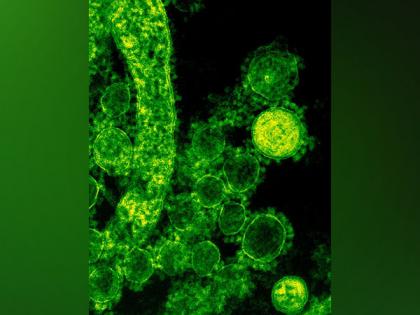 Defense against infections is improved by epigenetic emergency switch: Study | Defense against infections is improved by epigenetic emergency switch: Study