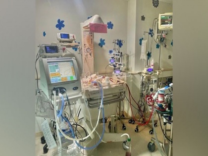 Manipal Hospital Old Airport Road successfully carried out bedside ECMO in Neonatal ICU, saves smallest low birth weight Newborn Baby | Manipal Hospital Old Airport Road successfully carried out bedside ECMO in Neonatal ICU, saves smallest low birth weight Newborn Baby