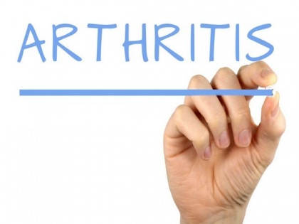 Artificial Intelligence searches for early sign of osteoarthritis: Research | Artificial Intelligence searches for early sign of osteoarthritis: Research
