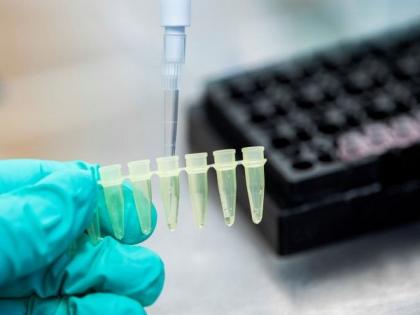 SARS-CoV-2: Was it a bio-weapon or natural pandemic? | SARS-CoV-2: Was it a bio-weapon or natural pandemic? SARS-CoV-2: Was it a bio-weapon or natural pandemic? | SARS-CoV-2: Was it a bio-weapon or natural pandemic?