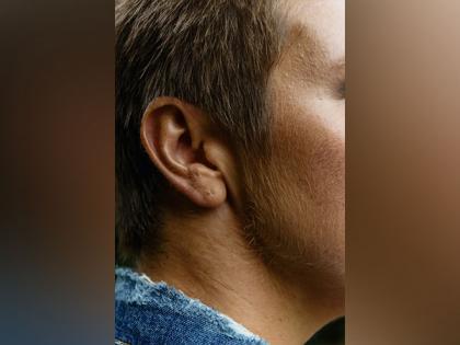 Research sheds light on organs of innermost ear which sense head position | Research sheds light on organs of innermost ear which sense head position