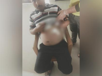 Karnataka: Man arrested for stabbing colleague in Bengaluru | Karnataka: Man arrested for stabbing colleague in Bengaluru
