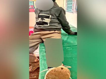 One injured in CPI-BJP clash outside polling station, informs Tripura CEO | One injured in CPI-BJP clash outside polling station, informs Tripura CEO One injured in CPI-BJP clash outside polling station, informs Tripura CEO | One injured in CPI-BJP clash outside polling station, informs Tripura CEO