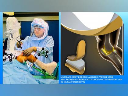 Mumbai's first robotic-assisted partial knee replacement surgery with gold coated implant led by Dr Santosh Shetty marks milestone in orthopedic care | Mumbai's first robotic-assisted partial knee replacement surgery with gold coated implant led by Dr Santosh Shetty marks milestone in orthopedic care