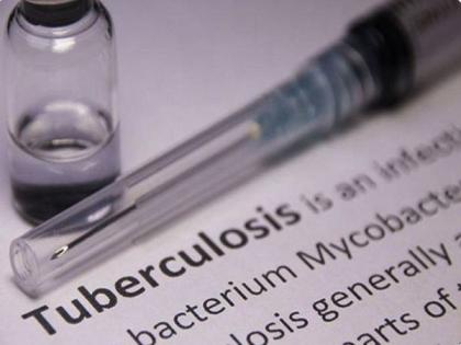 Private hospitals accelerate tuberculosis screening to achieve Mission TB-Free India | Private hospitals accelerate tuberculosis screening to achieve Mission TB-Free India Private hospitals accelerate tuberculosis screening to achieve Mission TB-Free India | Private hospitals accelerate tuberculosis screening to achieve Mission TB-Free India