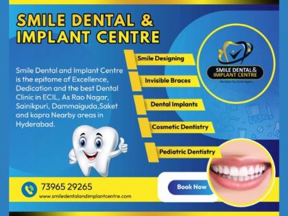 Smile Dental &amp; Implant Centre announces Advanced Dental Care Services in A S Rao Nagar, Ecil Hyderabad | Smile Dental &amp; Implant Centre announces Advanced Dental Care Services in A S Rao Nagar, Ecil Hyderabad