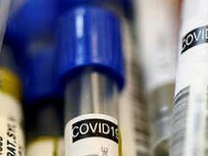 Uttarakhand reports one Covid death, 4 new cases in last 24 hours | Uttarakhand reports one Covid death, 4 new cases in last 24 hours Uttarakhand reports one Covid death, 4 new cases in last 24 hours | Uttarakhand reports one Covid death, 4 new cases in last 24 hours