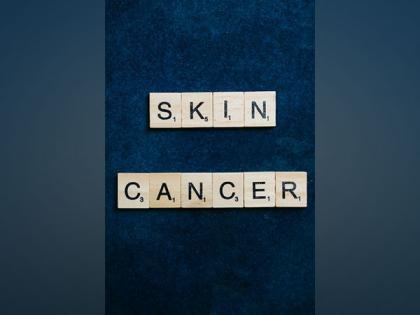 Researchers reveal how some skin cancer resist treatment | Researchers reveal how some skin cancer resist treatment