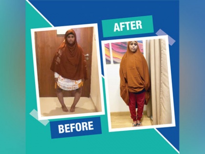 From Deformity to Mobility: 16-year-old girl's life transformed with corrective surgery by doctors at Manipal Hospitals, Delhi | From Deformity to Mobility: 16-year-old girl's life transformed with corrective surgery by doctors at Manipal Hospitals, Delhi