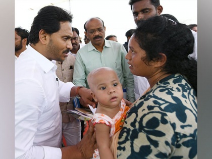 Andhra CM extends financial help to cancer-stricken baby | Andhra CM extends financial help to cancer-stricken baby