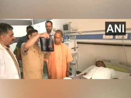 Lucknow court firing: CM Yogi meets injured in hospital | Lucknow court firing: CM Yogi meets injured in hospital
