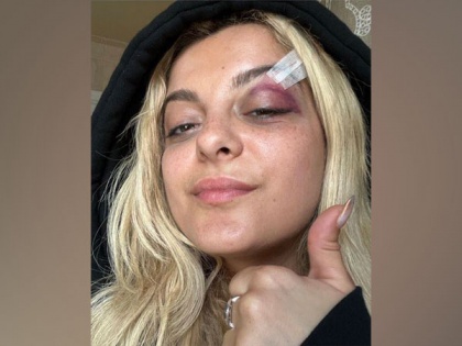 Bebe Rexha rushed off stage after being hit in head with phone by fan | Bebe Rexha rushed off stage after being hit in head with phone by fan