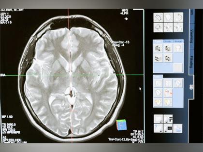 Monitoring brain waves could reduce post-op complications: Study | Monitoring brain waves could reduce post-op complications: Study Monitoring brain waves could reduce post-op complications: Study | Monitoring brain waves could reduce post-op complications: Study