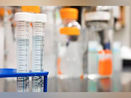 Study finds new method to reverse effects of fentanyl | Study finds new method to reverse effects of fentanyl Study finds new method to reverse effects of fentanyl | Study finds new method to reverse effects of fentanyl