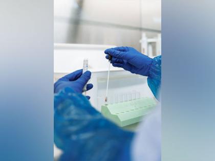 Scientific breakthrough uses mRNA technology to create a highly effective malaria vaccine | Scientific breakthrough uses mRNA technology to create a highly effective malaria vaccine Scientific breakthrough uses mRNA technology to create a highly effective malaria vaccine | Scientific breakthrough uses mRNA technology to create a highly effective malaria vaccine