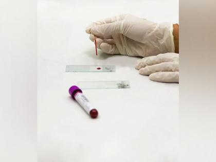 Digital pathology set to be game changer in medical industry | Digital pathology set to be game changer in medical industry Digital pathology set to be game changer in medical industry | Digital pathology set to be game changer in medical industry