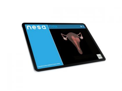 Nesa Medtech receives US FDA clearance for technology in women’s health | Nesa Medtech receives US FDA clearance for technology in women’s health Nesa Medtech receives US FDA clearance for technology in women’s health | Nesa Medtech receives US FDA clearance for technology in women’s health