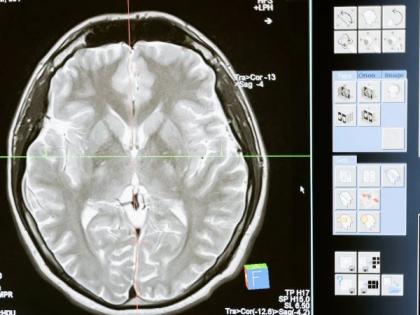Study establishes direct connection between brain waves, memory | Study establishes direct connection between brain waves, memory Study establishes direct connection between brain waves, memory | Study establishes direct connection between brain waves, memory