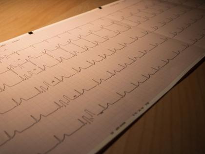 High level of protein used to exclude heart attack may signal risk of death: Study | High level of protein used to exclude heart attack may signal risk of death: Study High level of protein used to exclude heart attack may signal risk of death: Study | High level of protein used to exclude heart attack may signal risk of death: Study