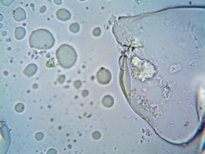 Study finds AI system that analyse cells for faster diagnosis of blood diseases | Study finds AI system that analyse cells for faster diagnosis of blood diseases Study finds AI system that analyse cells for faster diagnosis of blood diseases | Study finds AI system that analyse cells for faster diagnosis of blood diseases