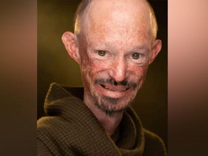 'Game of Thrones' actor Darren Kent passes away | 'Game of Thrones' actor Darren Kent passes away 'Game of Thrones' actor Darren Kent passes away | 'Game of Thrones' actor Darren Kent passes away