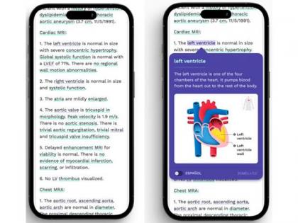 Aarthi Scans introduces Smart Reports for MRI and CT Scans | Aarthi Scans introduces Smart Reports for MRI and CT Scans Aarthi Scans introduces Smart Reports for MRI and CT Scans | Aarthi Scans introduces Smart Reports for MRI and CT Scans