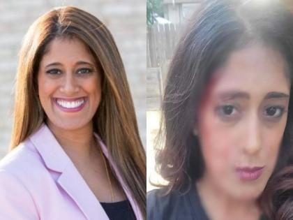Minnesota Democratic party official who called for police dismantling, beaten, left bloodied in carjacking | Minnesota Democratic party official who called for police dismantling, beaten, left bloodied in carjacking Minnesota Democratic party official who called for police dismantling, beaten, left bloodied in carjacking | Minnesota Democratic party official who called for police dismantling, beaten, left bloodied in carjacking