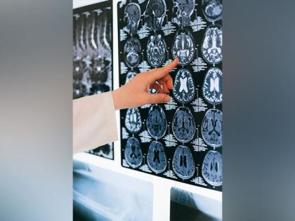 Adult brain's plasticity is controlled by thalamus: Study | Adult brain's plasticity is controlled by thalamus: Study