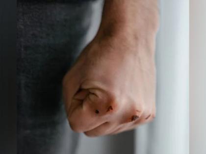 Researchers develop new hydrogels for wound management | Researchers develop new hydrogels for wound management Researchers develop new hydrogels for wound management | Researchers develop new hydrogels for wound management