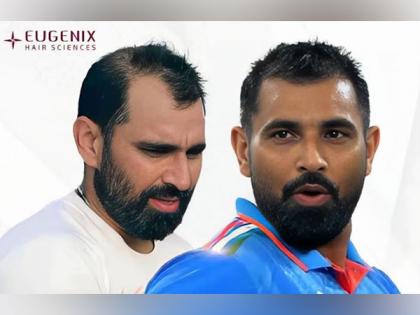 Mohammed Shami: A Stunning Transformation On and Off the Pitch | Mohammed Shami: A Stunning Transformation On and Off the Pitch