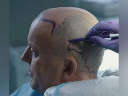 Top 20 Best Hair Transplants in Turkey and Hair Transplant Costs | Top 20 Best Hair Transplants in Turkey and Hair Transplant Costs