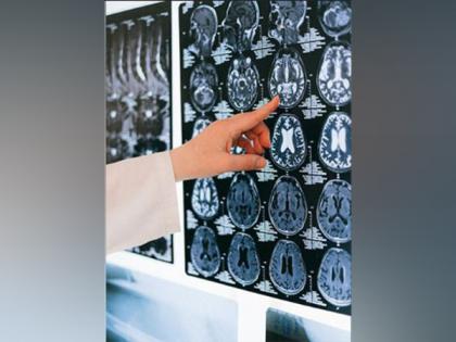 Researchers find how climate change could affect brain | Researchers find how climate change could affect brain