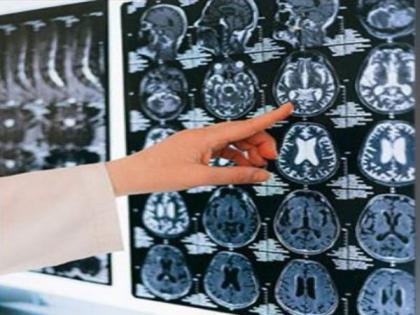 Researchers give more insight into how our brains perceive | Researchers give more insight into how our brains perceive Researchers give more insight into how our brains perceive | Researchers give more insight into how our brains perceive