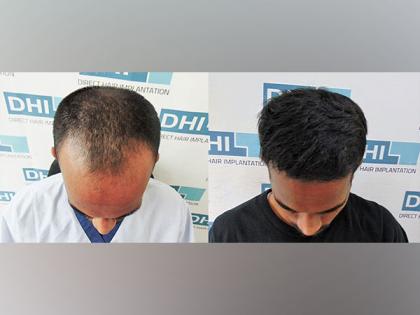 Exclusive Technique Now Available Only in DHI's Authorized Clinics | Exclusive Technique Now Available Only in DHI's Authorized Clinics Exclusive Technique Now Available Only in DHI's Authorized Clinics | Exclusive Technique Now Available Only in DHI's Authorized Clinics