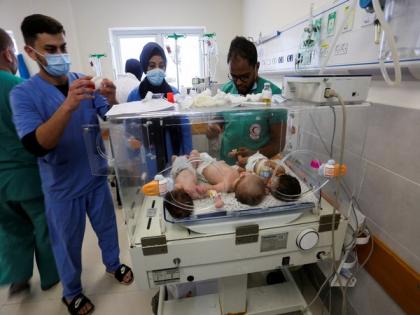 Thirty-one children evacuated from Al-Shifa Hospital in Gaza, to be moved to Egypt | Thirty-one children evacuated from Al-Shifa Hospital in Gaza, to be moved to Egypt Thirty-one children evacuated from Al-Shifa Hospital in Gaza, to be moved to Egypt | Thirty-one children evacuated from Al-Shifa Hospital in Gaza, to be moved to Egypt