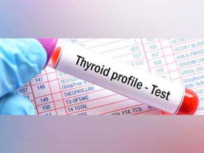 Unable to Lose Weight? Thyroid Imbalance might be the Reason | Unable to Lose Weight? Thyroid Imbalance might be the Reason Unable to Lose Weight? Thyroid Imbalance might be the Reason | Unable to Lose Weight? Thyroid Imbalance might be the Reason