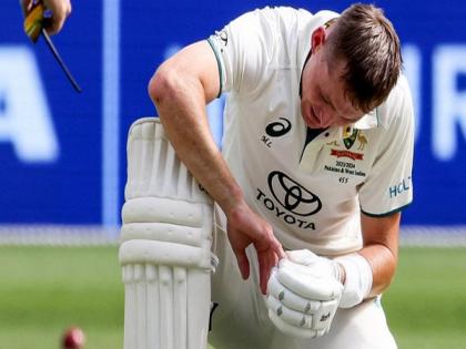 Australia batter Marnus Labuschagne to undergo scan after copping blow to his finger | Australia batter Marnus Labuschagne to undergo scan after copping blow to his finger