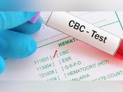 Signs You Require a CBC Test | Signs You Require a CBC Test Signs You Require a CBC Test | Signs You Require a CBC Test