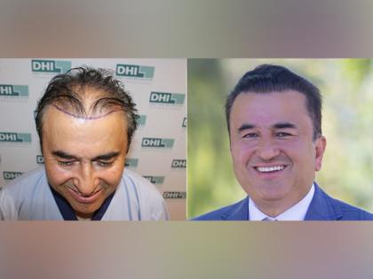 Why is India a Growing Hair Transplant Destination? | Why is India a Growing Hair Transplant Destination? Why is India a Growing Hair Transplant Destination? | Why is India a Growing Hair Transplant Destination?