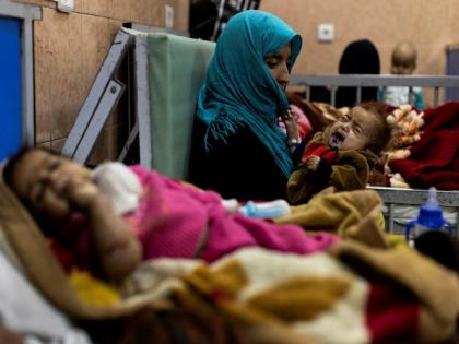 UN raises alarm over escalating malnutrition among women, children in Afghanistan | UN raises alarm over escalating malnutrition among women, children in Afghanistan