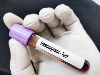 Why is a Hemogram Test Prescribed? | Why is a Hemogram Test Prescribed? Why is a Hemogram Test Prescribed? | Why is a Hemogram Test Prescribed?