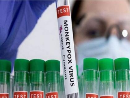 DR Congo receives first mpox vaccine shipment to combat outbreak | DR Congo receives first mpox vaccine shipment to combat outbreak DR Congo receives first mpox vaccine shipment to combat outbreak | DR Congo receives first mpox vaccine shipment to combat outbreak