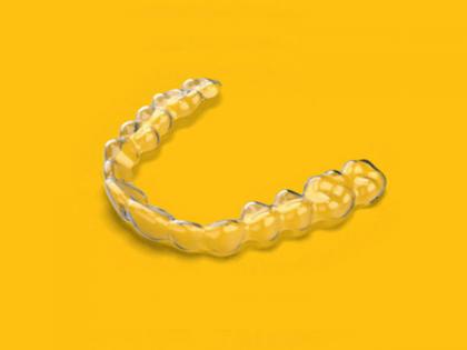 OrthoFX™ Launches NiTime™ Aligners in India: Revolutionizing Patient Compliance and Predictability | OrthoFX™ Launches NiTime™ Aligners in India: Revolutionizing Patient Compliance and Predictability OrthoFX™ Launches NiTime™ Aligners in India: Revolutionizing Patient Compliance and Predictability | OrthoFX™ Launches NiTime™ Aligners in India: Revolutionizing Patient Compliance and Predictability