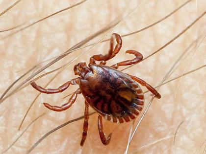Balochistan records another Congo virus case, tally rises to 41 cases | Balochistan records another Congo virus case, tally rises to 41 cases Balochistan records another Congo virus case, tally rises to 41 cases | Balochistan records another Congo virus case, tally rises to 41 cases