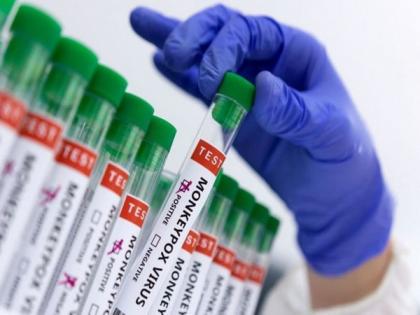 Sierra Leone confirms first Mpox case | Sierra Leone confirms first Mpox case Sierra Leone confirms first Mpox case | Sierra Leone confirms first Mpox case