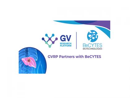 GV Research Platform and BeCytes Partner to Enhance Access to Certified Hepatocytes & Biological Samples, Advancing Biopharma Research in India | GV Research Platform and BeCytes Partner to Enhance Access to Certified Hepatocytes & Biological Samples, Advancing Biopharma Research in India GV Research Platform and BeCytes Partner to Enhance Access to Certified Hepatocytes & Biological Samples, Advancing Biopharma Research in India | GV Research Platform and BeCytes Partner to Enhance Access to Certified Hepatocytes & Biological Samples, Advancing Biopharma Research in India