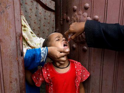Pakistan reports second polio case of 2025 | Pakistan reports second polio case of 2025 Pakistan reports second polio case of 2025 | Pakistan reports second polio case of 2025