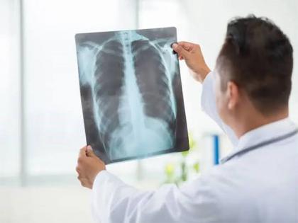 Signs You May Require an X-ray | Signs You May Require an X-ray Signs You May Require an X-ray | Signs You May Require an X-ray