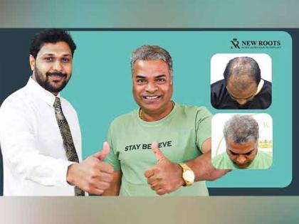 Actor Producer Bharat Jadhav Overcomes Failed Hair Treatment with the Help from New Roots | Actor Producer Bharat Jadhav Overcomes Failed Hair Treatment with the Help from New Roots Actor Producer Bharat Jadhav Overcomes Failed Hair Treatment with the Help from New Roots | Actor Producer Bharat Jadhav Overcomes Failed Hair Treatment with the Help from New Roots